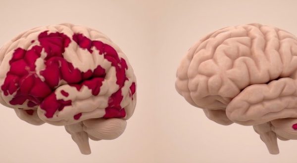 Trauma re-processing and integration